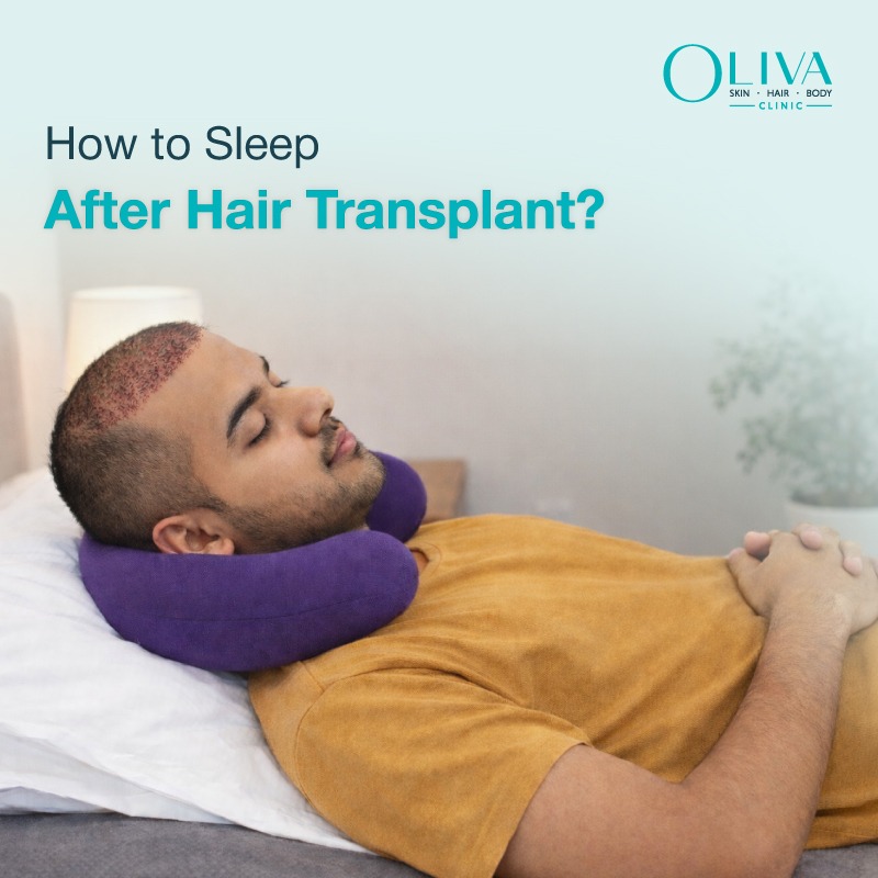How to Sleep After Hair Transplant